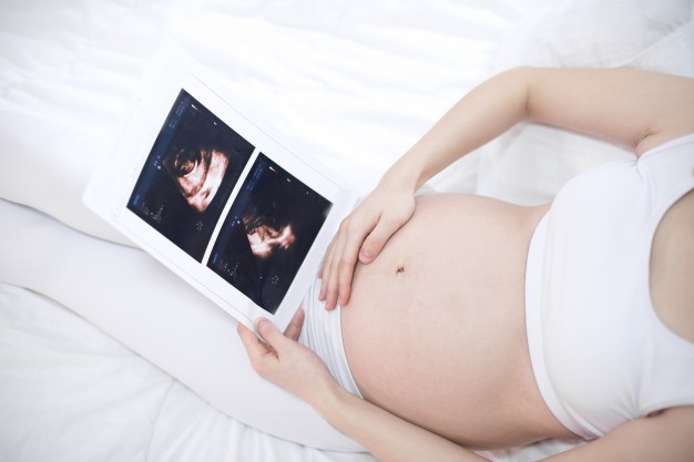 Baby Vídeo