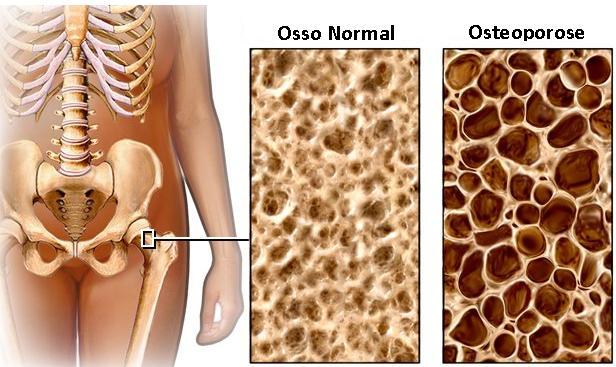 Densitometria Óssea Radioclin